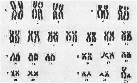 Human karyotypes