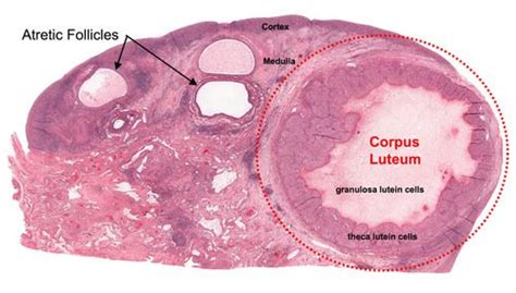 Ovary - Corpus Luteum Histology