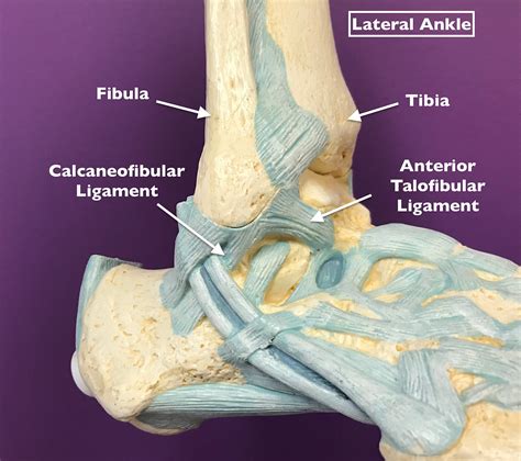 The Basics of a Common Ankle Sprain