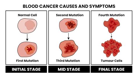 Blood Cancer - Types, Symptoms, Causes and its Treatment