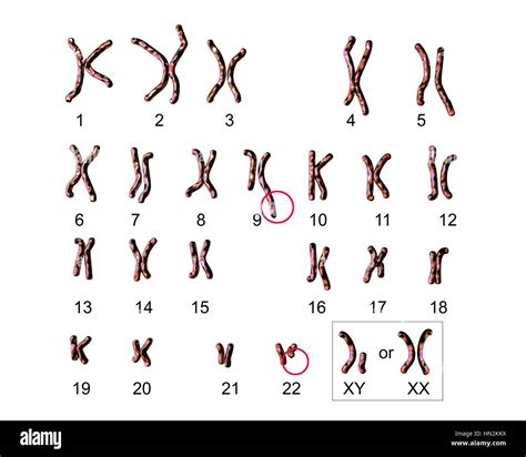 Philadelphia chromosome.Computer illustration of male or female ...