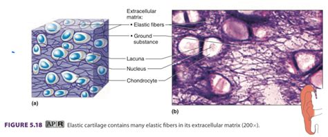 Elastic Cartilage Diagram | Quizlet