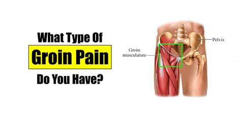 Groin Pain - HealthnPhysio