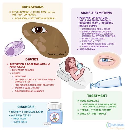 Postpartum Hives: What Are They, Causes, Symptoms, and More | Osmosis