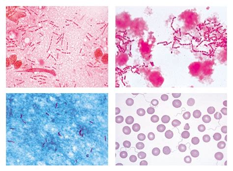 Pathogenic Bacteria Slide Set | Flinn Scientific