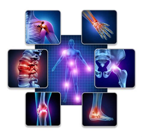 Comprehensive Osteoarthritis Treatment for a Pain-Free Life | Expert ...