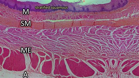 Esophagus Histology Diagram