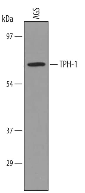 Tryptophan Hydroxylase 1/TPH-1 Antibody [Unconjugated] (AF5276): Novus ...