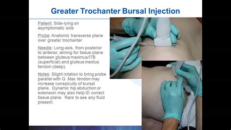 Introduction to MSK Ultrasound Guided Procedures with Dr. Gruba Part 4 ...