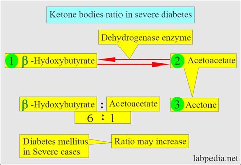 Urine for ketones, and Ketone Bodies (Ketonuria) - Labpedia.net