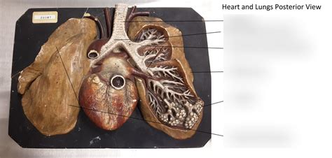 Anatomy II - Posterior View of the Heart and Lungs Diagram | Quizlet