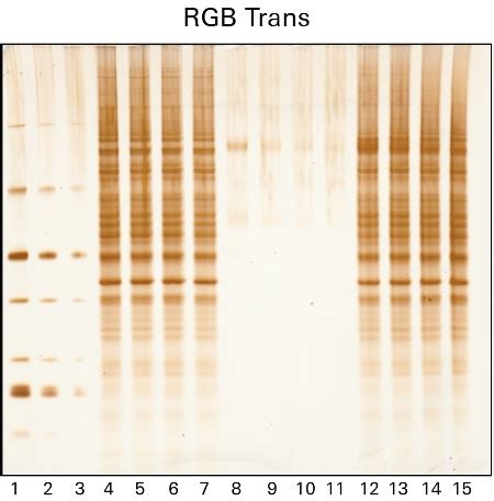 Image a Variety of Fluorescent and Colorimetric Protein Gel Stains on ...