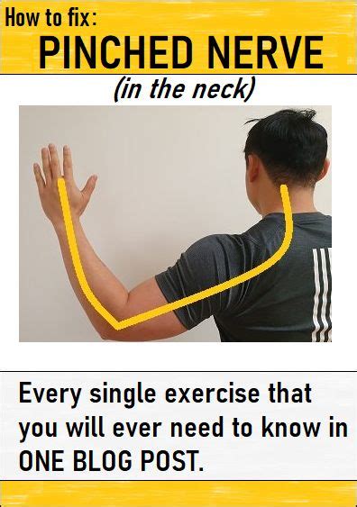 23 Best Exercises For A Pinched Nerve In The Neck images in 2020 ...