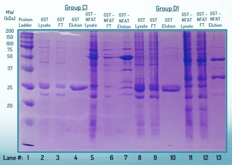 lab techniques - Help analyzing SDS-Page gel - Biology Stack Exchange