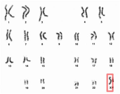 What is the Difference Between XX and XY Chromosomes - Pediaa.Com