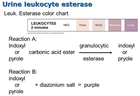 Leukocyte Esterase - Urine, What is?, Clinical Significance