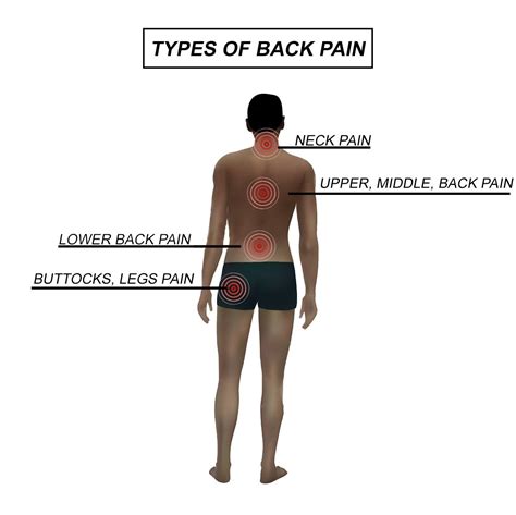 Back Pain Center: Upper, Mid & Lower Back | El Paso, TX Doctor Of ...