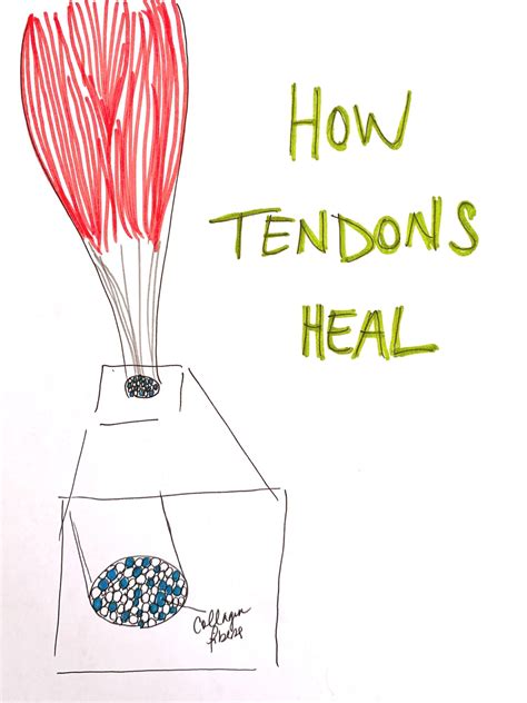 How to Heal Tendonitis without Sacrificing your Workouts — Chelsea ...