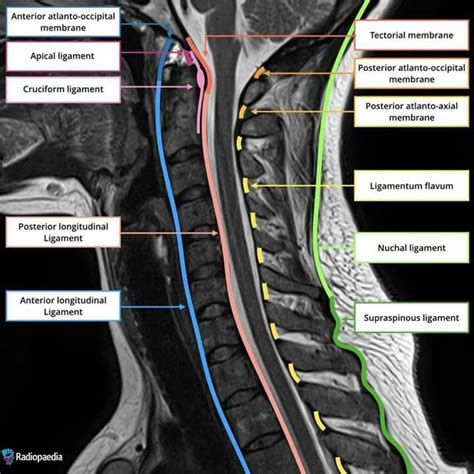 Pin by Alan Etienne on MRI | Medical anatomy, Medical knowledge