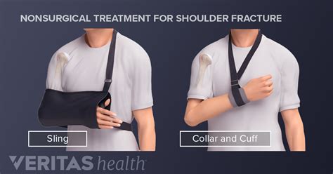 Proximal Humerus Fracture Exercises