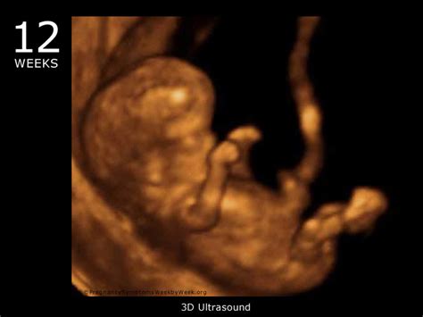 30 weeks pregnant 3d ultrasound - vividpadi