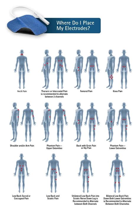 Tens Electrode Placement Chart Shoulder