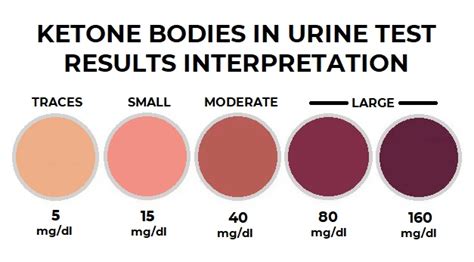 Ketonuria Test - Detection of ketone bodies in Urine