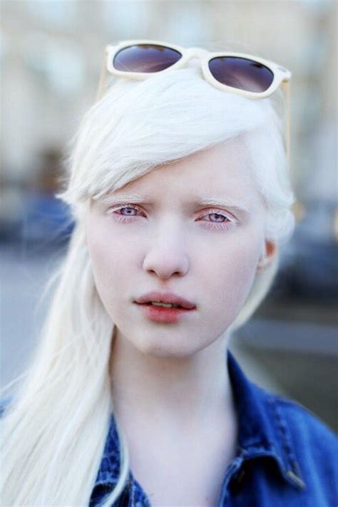 Pin on Nastya Zhidkova Albino Model