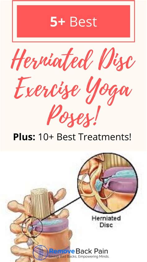 Pin on Herniated Disc Exercise Yoga Poses