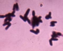 Week 5-Gram-positive Non-spore forming Bacillus (rods) Flashcards | Quizlet