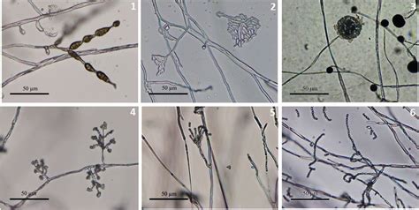 The morphological characteristics of hyphae and conidiophores by light ...