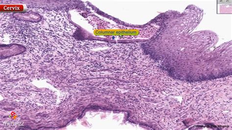 Histology of cervix - Shotgun Histology - YouTube