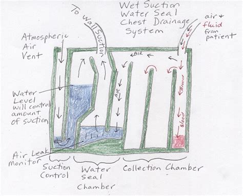 Water Seal Chest Tube Drainage System