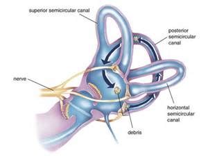 CAN LOOSE CRYSTALS CAUSE DIZZINESS? | Ear and Balance