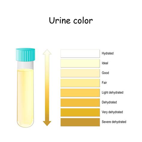 10,500+ Urine Stock Illustrations, Royalty-Free Vector Graphics & Clip ...