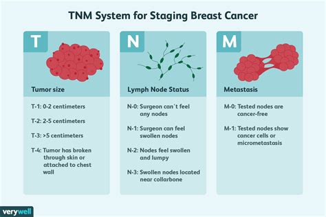 Breast Cancer Tumor Size and Stage