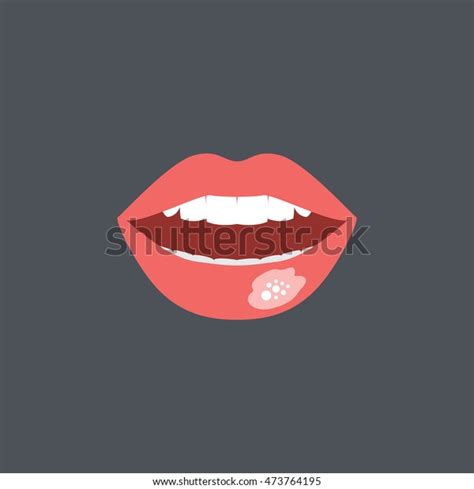 Mouth Sores Icon Flat Style Stock Vector (Royalty Free) 473764195