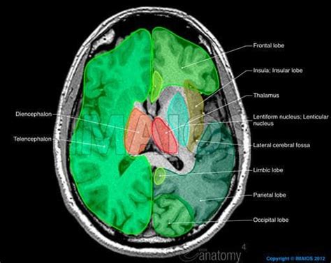 Brain Lobes Ct Anatomy