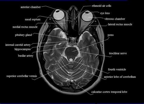 Brain Lobe Anatomy Mri