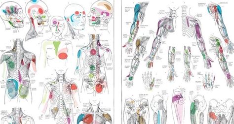 Muscle Knots Archives - Myofascial Pain Solutions