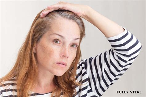 Frontal Fibrosing Alopecia: Understanding and Solutions | FullyVital