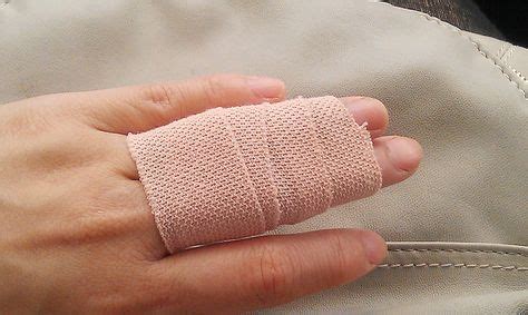 How do you heal a sprained finger fast? - SportsMD