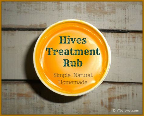 Hives Treatment: A Natural Homemade Healing Rub Recipe