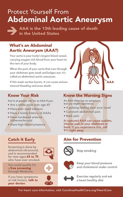 Aortic aneurysm – Artofit