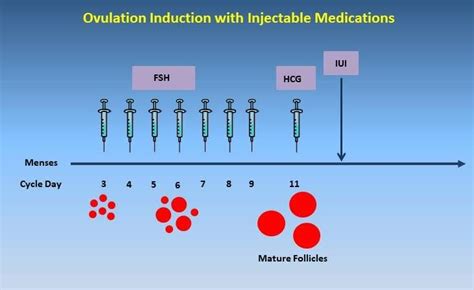 Ovulation Induction Specialist - Irving, TX & Arlington, TX: IVFMD ...