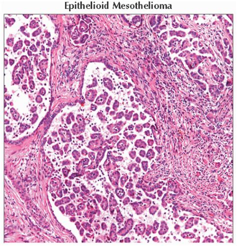 Pleura Histology