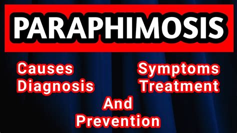 Paraphimosis : Causes, Symptoms, Diagnosis, Treatment And Prevention ...