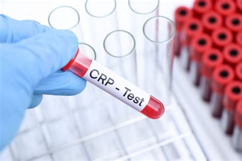 An Introduction to the Inflammatory Markers Used in Blood Tests - GlycanAge