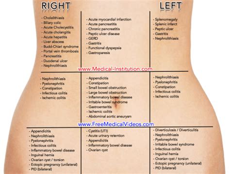 Abdominal Pain Differential Diagnosis | Medical Institution