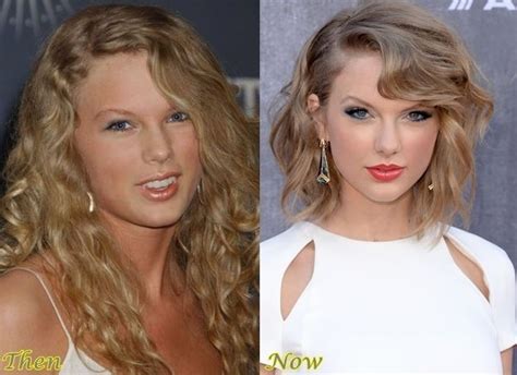 Taylor Swift before and after plastic surgery 04 | Celebrity plastic ...